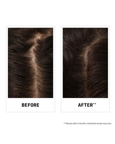 Shampoing Antichute au sandalore™ Nioxin 240ml