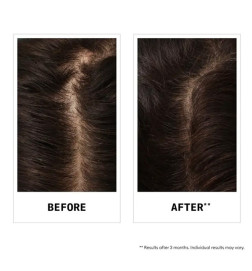 Shampoing Antichute au sandalore™ Nioxin 240ml