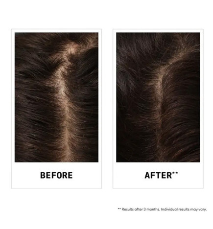 Shampoing Antichute au sandalore™ Nioxin 240ml