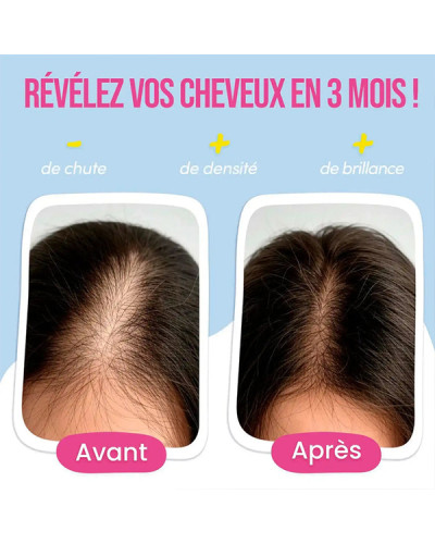 Gummies Anti-Chute de Cheveux 60 gélules Myriam K