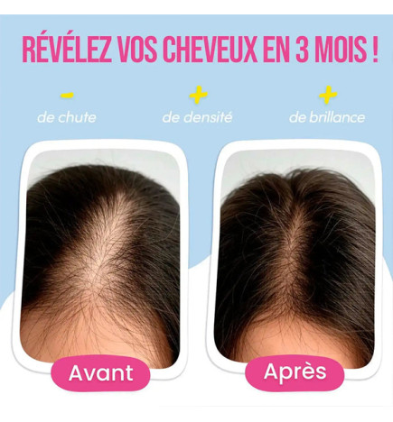 Gummies Anti-Chute de Cheveux 60 gélules Myriam K