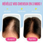 Gummies Anti-Chute de Cheveux 60 gélules Myriam K Gummies Anti-Chute de Cheveux 60 gélules Myriam K
